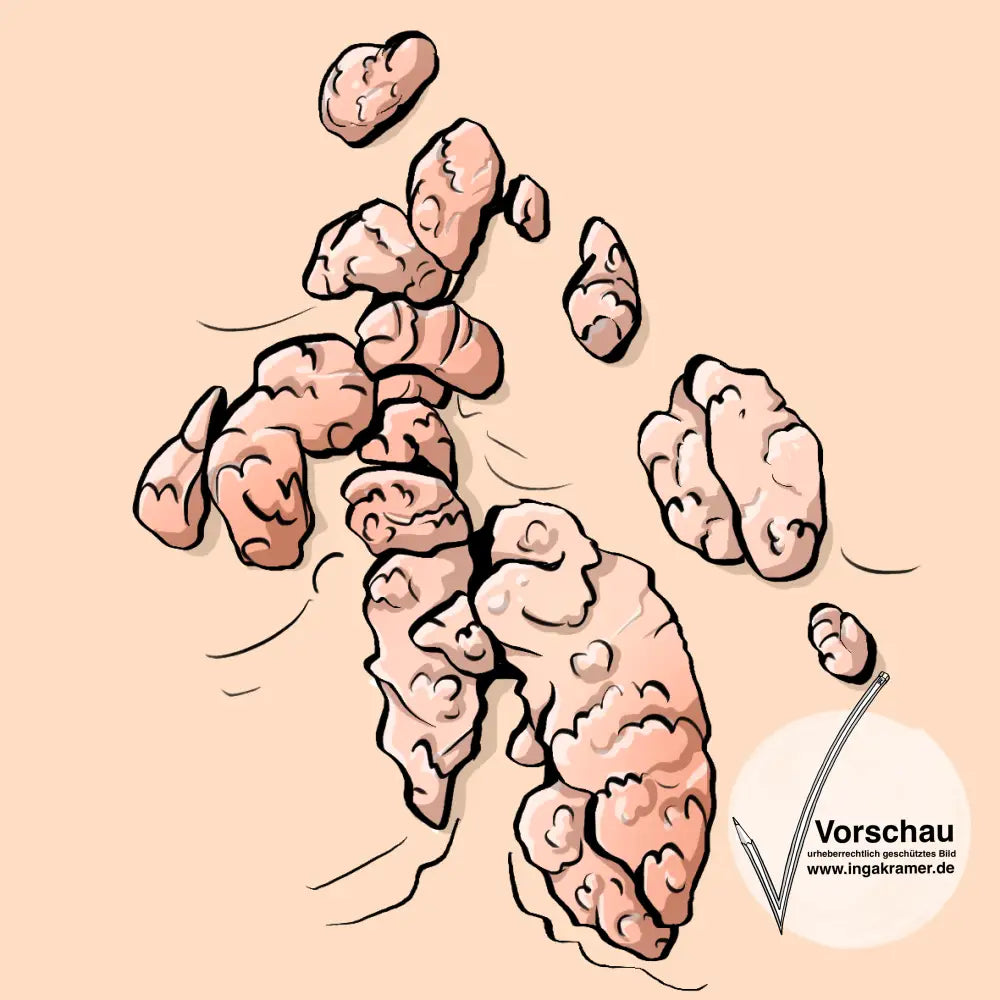 Ein Bild von Warzen.