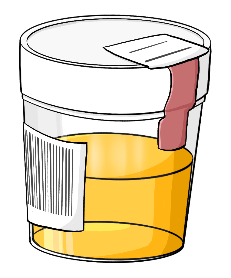 Urinprobe – Inga Kramer