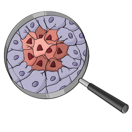 Eine Lupe. Unter der Lupe ist eine Ansammlung von unregelmäßigen Zellen.
