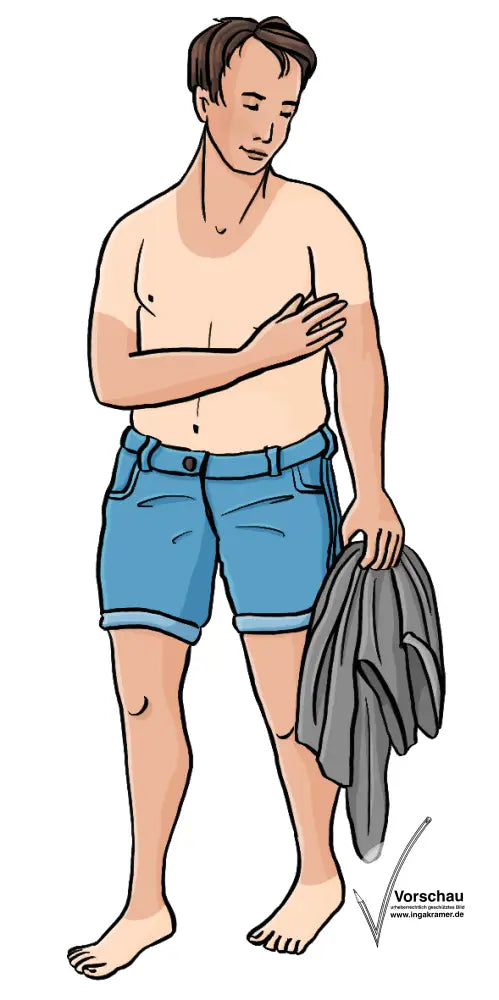 Ein Mann mit nacktem Oberkörper. Er hält sein T-Shirt in der Hand und schaut auf seinen linken Arm. Die Haut an Gesicht, Unterarmen und die Beinen ist deutlich dunkler als an Bauch, Brust und Füßen.