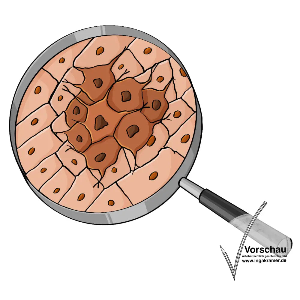 Alternativtext: Eine Lupe. Unter der Lupe ist eine Ansammlung von unregelmäßigen Zellen.
