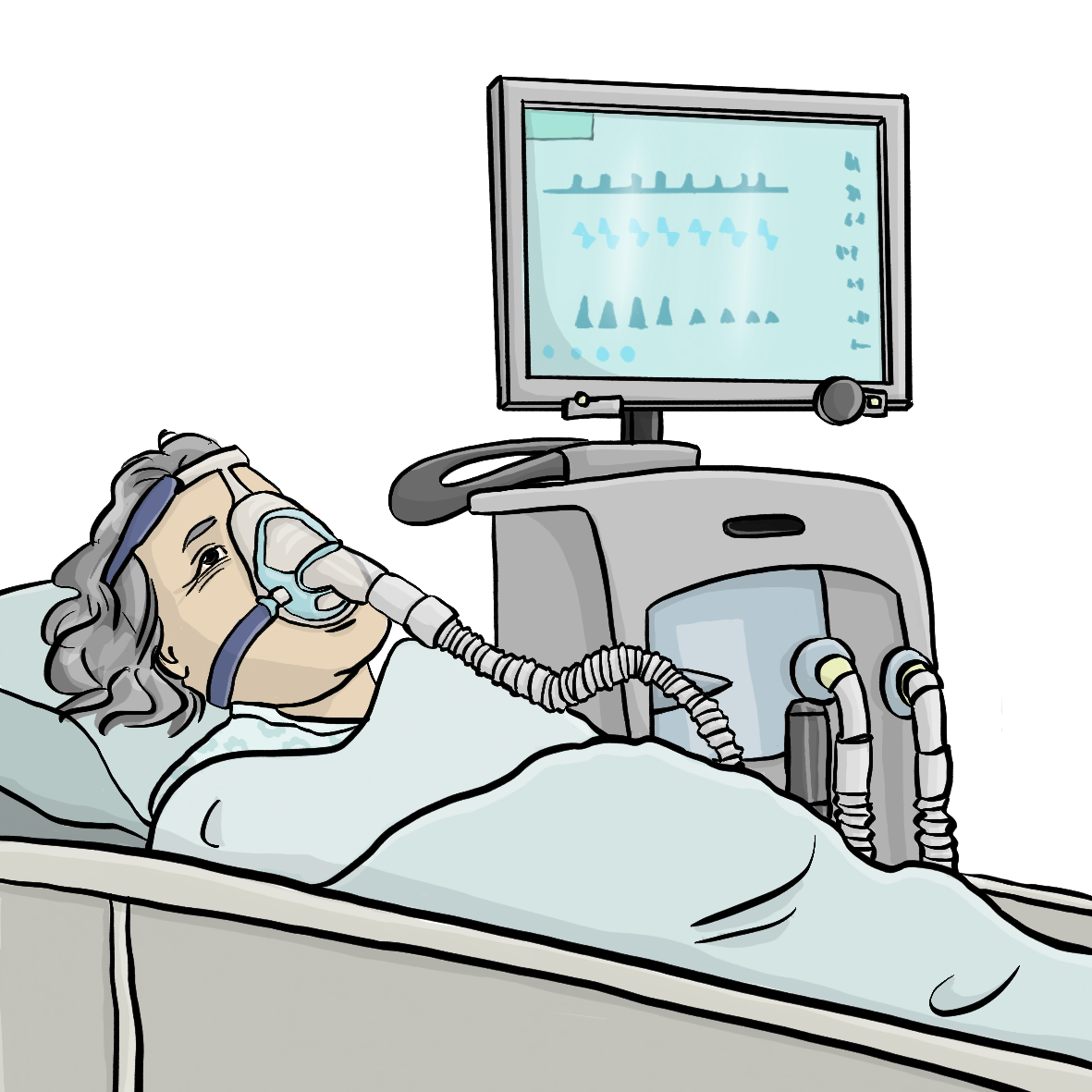 Eine ältere Frau liegt in einem Intensiv-Bett. Sie trägt eine Sauerstoff-Maske. Neben dem Bett steht ein Beatmungsgerät.