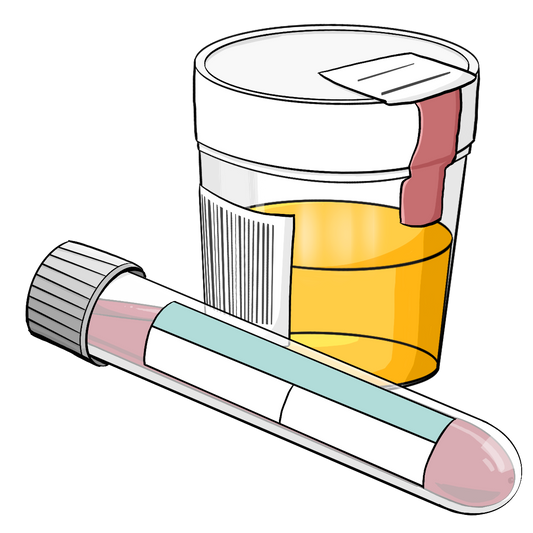 Ein Röhrchen mit Blut liegt vor einem Becher mit Urin.