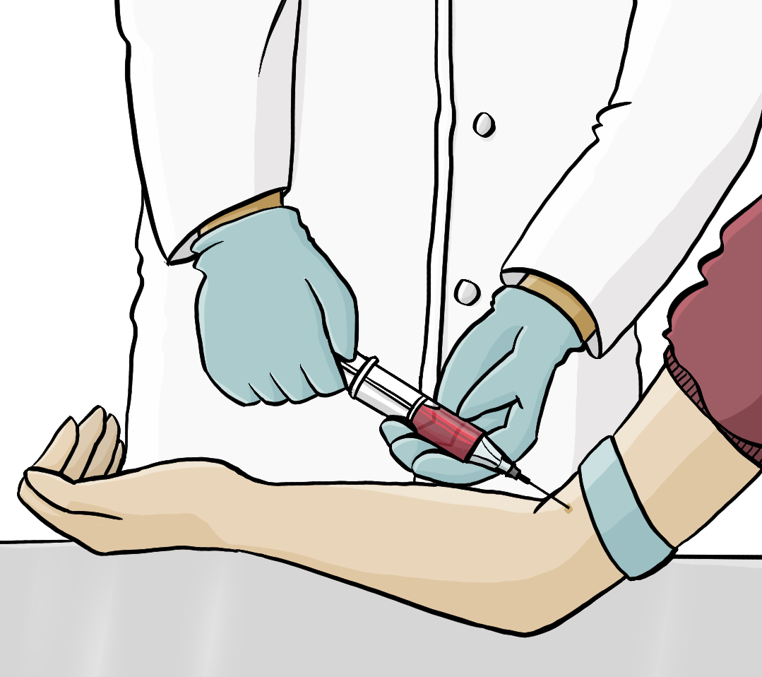 Ein Arzt oder eine Ärtzin nimmt einer Person Blut ab. Man sieht nur den Unterarm mit der Manschette, die Hände vom Arzt und die Spritze mit dem Blut.
