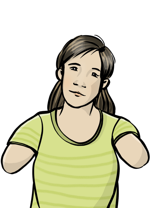 Eine Frau mit Dysmelie. Ihre Arme Enden kurz nach der Schulter.