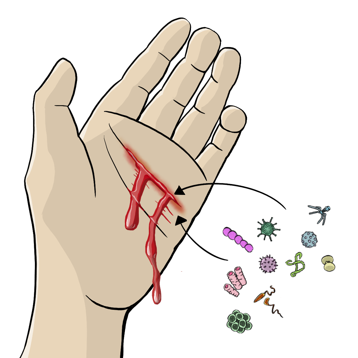 Eine Hand mit einer blutenden Wunde. Neben der Hand sind Viren und Bakterien. Pfeile zeigen von den Viren und Bakterien auf die Wunde. 
