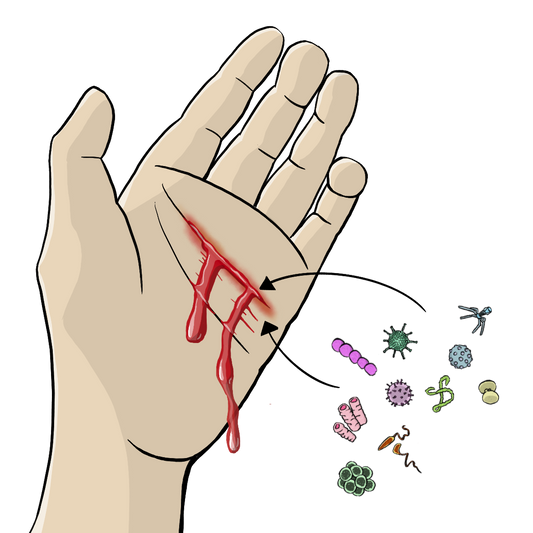 Eine Hand mit einer blutenden Wunde. Neben der Hand sind Viren und Bakterien. Pfeile zeigen von den Viren und Bakterien auf die Wunde. 