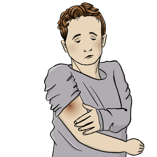 Ein Mann hält sich den Arm. Auf dem Oberarm ist eine gerötete Stelle.