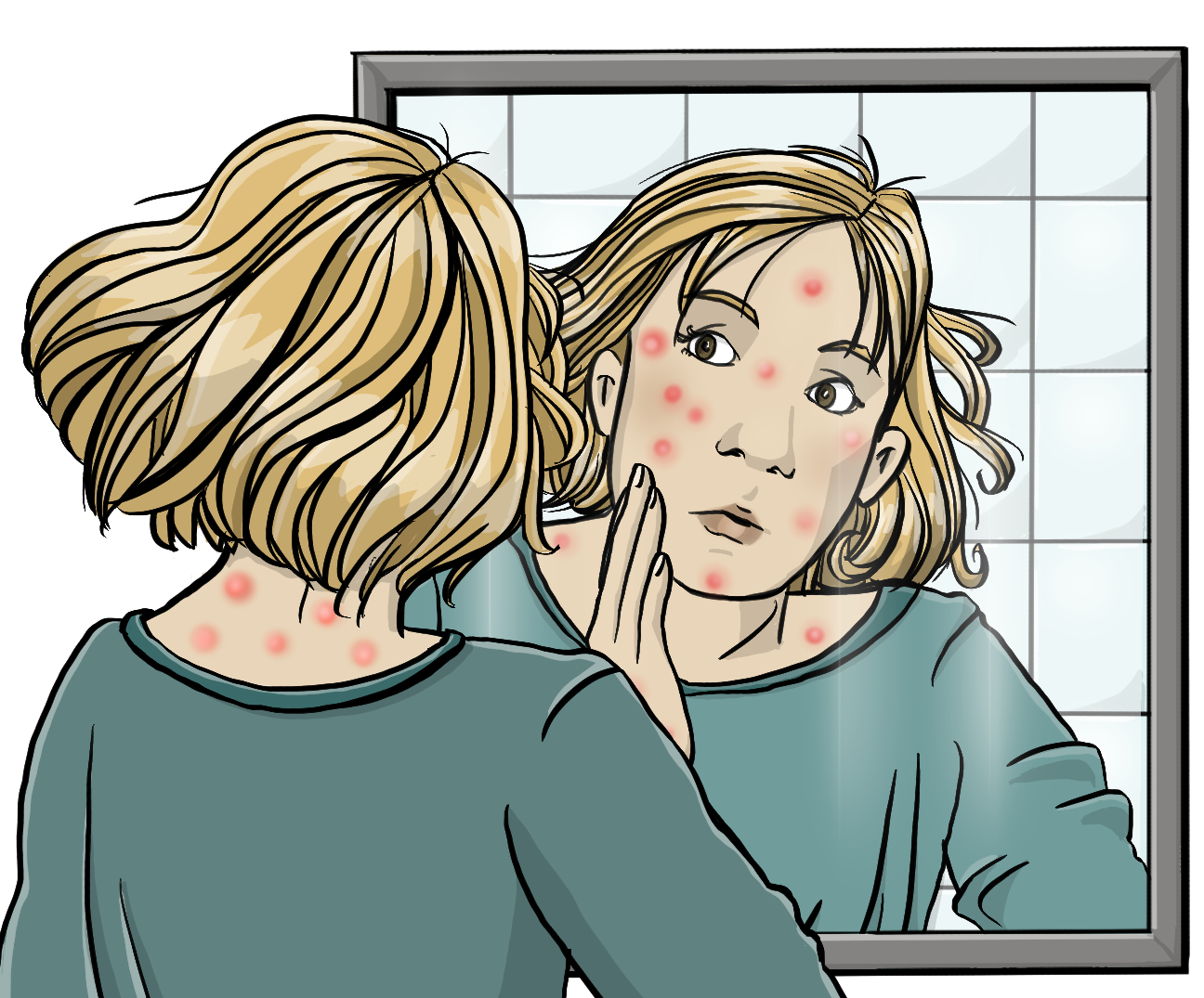 Eine Frau schaut erschrocken in einen Spiegel und hält die Hand an die Wange. In ihrem Gesicht und im Nacken sind viele rote Punkte. 